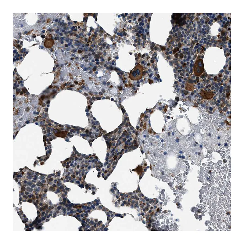 Atlas Antibodies Anti-ZFAND2A Antibody