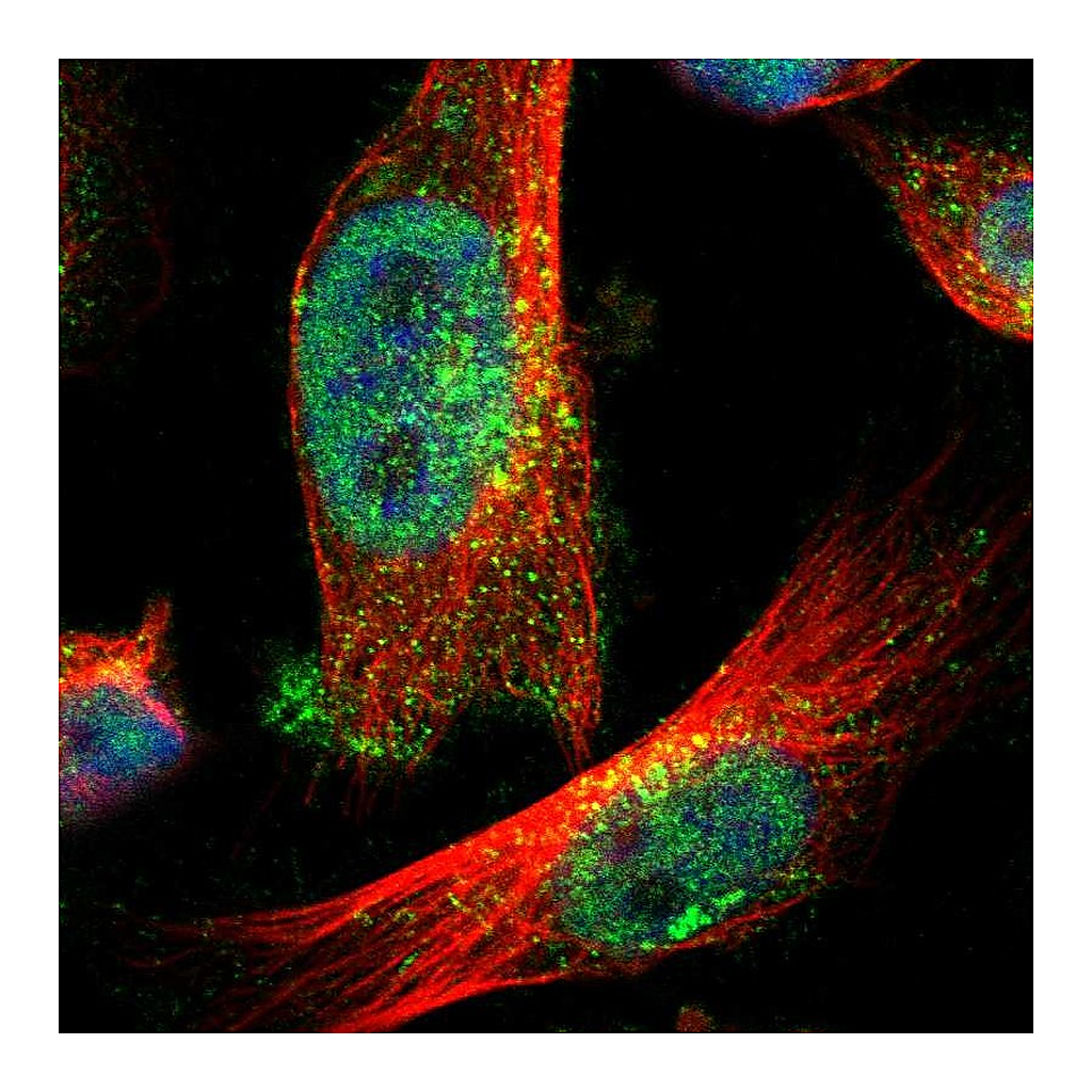 Atlas Antibodies Anti-ZFAND3 Antibody