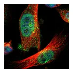 Atlas Antibodies Anti-ZFAND3 Antibody
