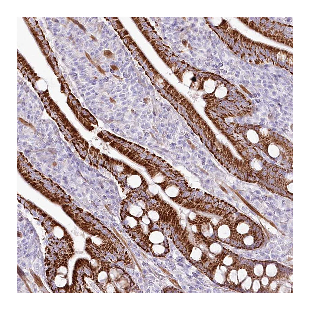 Atlas Antibodies Anti-ZFAND4 Antibody