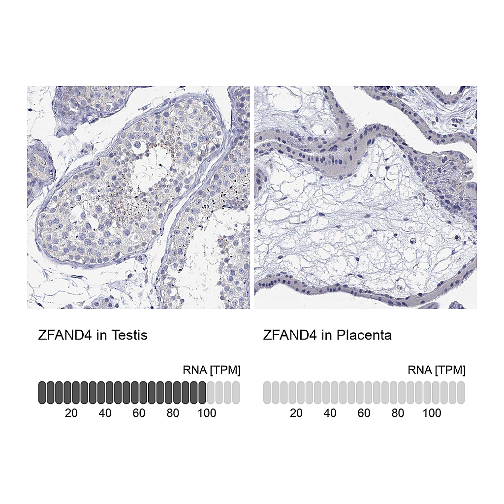 Atlas Antibodies Anti-ZFAND4 Antibody