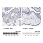 Atlas Antibodies Anti-ZFAND4 Antibody