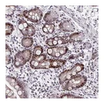 Atlas Antibodies Anti-ZFHX3 Antibody