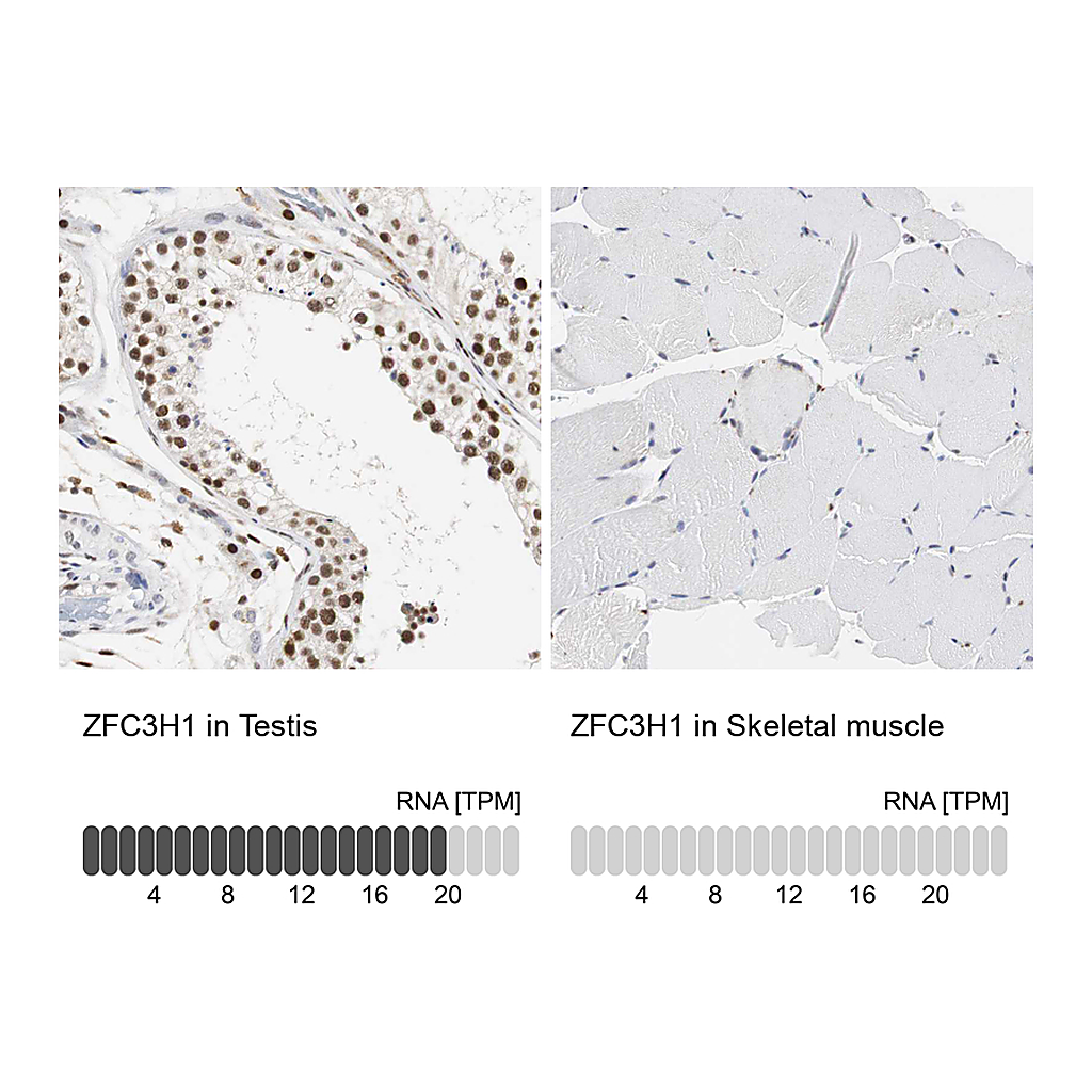 Atlas Antibodies Anti-ZFC3H1 Antibody