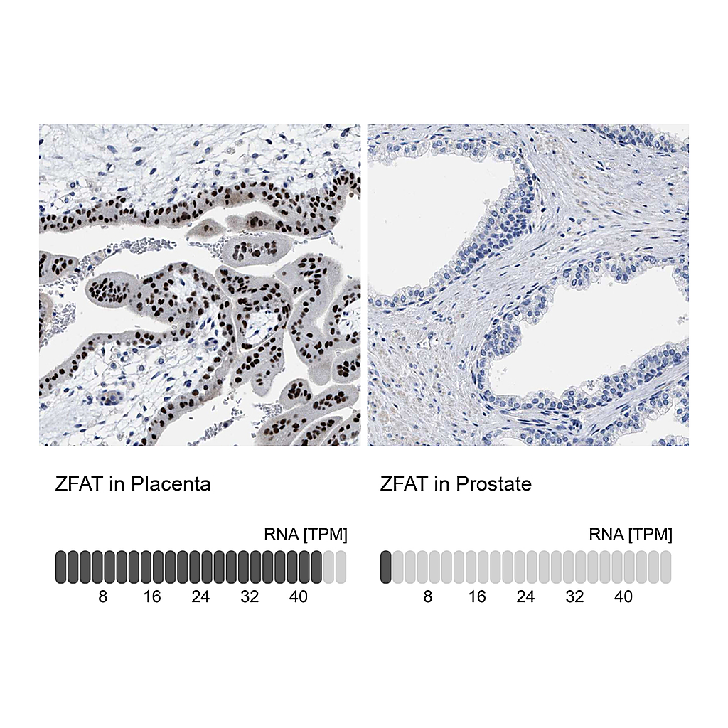 Atlas Antibodies Anti-ZFAT Antibody