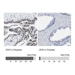 Atlas Antibodies Anti-ZFAT Antibody