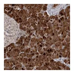 Atlas Antibodies Anti-ZFP14 Antibody