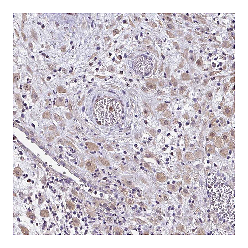 Atlas Antibodies Anti-ZFP1 Antibody