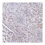 Atlas Antibodies Anti-ZFP1 Antibody