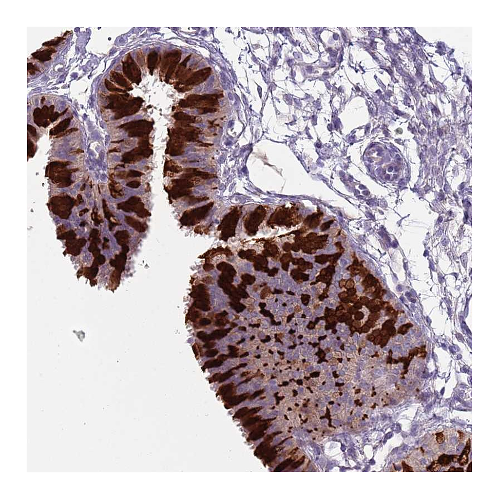 Atlas Antibodies Anti-ZFP2 Antibody