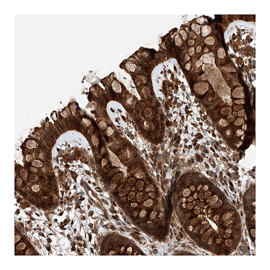 Atlas Antibodies Anti-ZFP28 Antibody