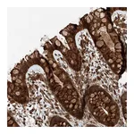 Atlas Antibodies Anti-ZFP28 Antibody