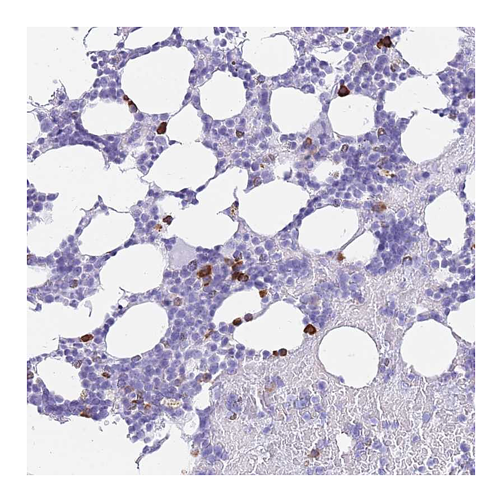 Atlas Antibodies Anti-ZFP37 Antibody