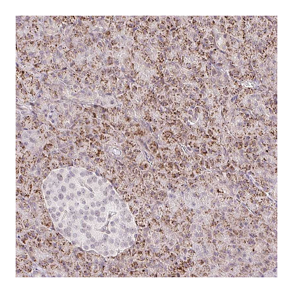 Atlas Antibodies Anti-ZFP41 Antibody