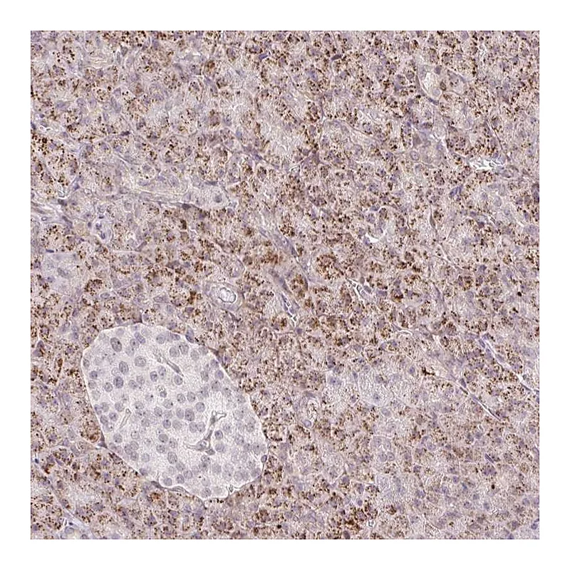 Atlas Antibodies Anti-ZFP41 Antibody