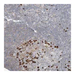 Atlas Antibodies Anti-ZFP30 Antibody