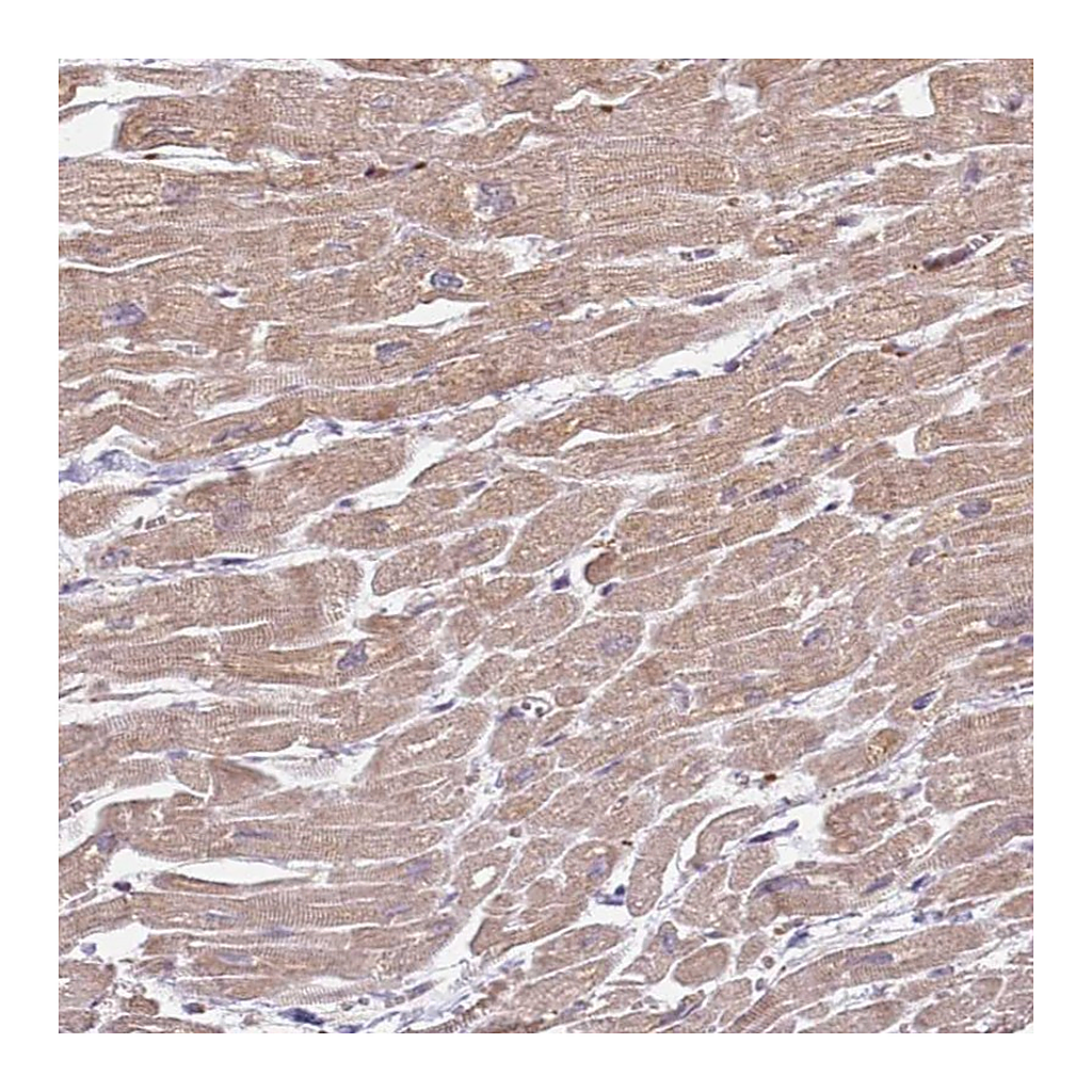 Atlas Antibodies Anti-ZFP57 Antibody
