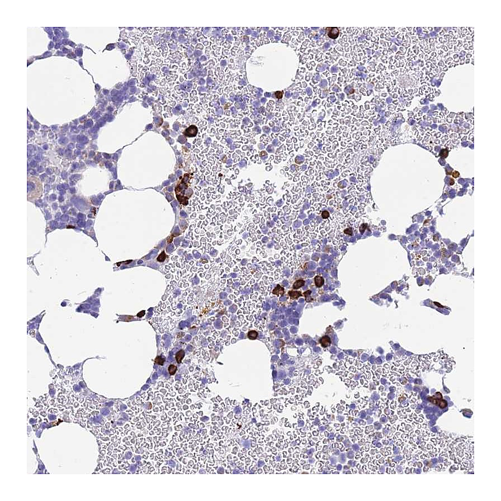 Atlas Antibodies Anti-ZFP62 Antibody