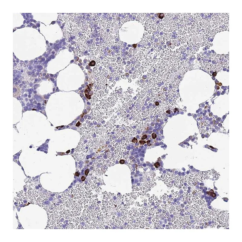 Atlas Antibodies Anti-ZFP62 Antibody