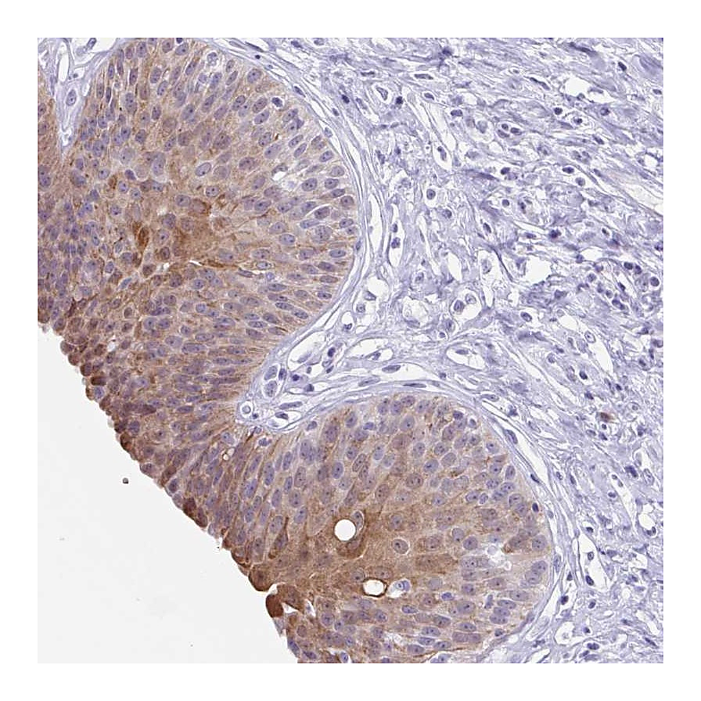 Atlas Antibodies Anti-ZFP64 Antibody
