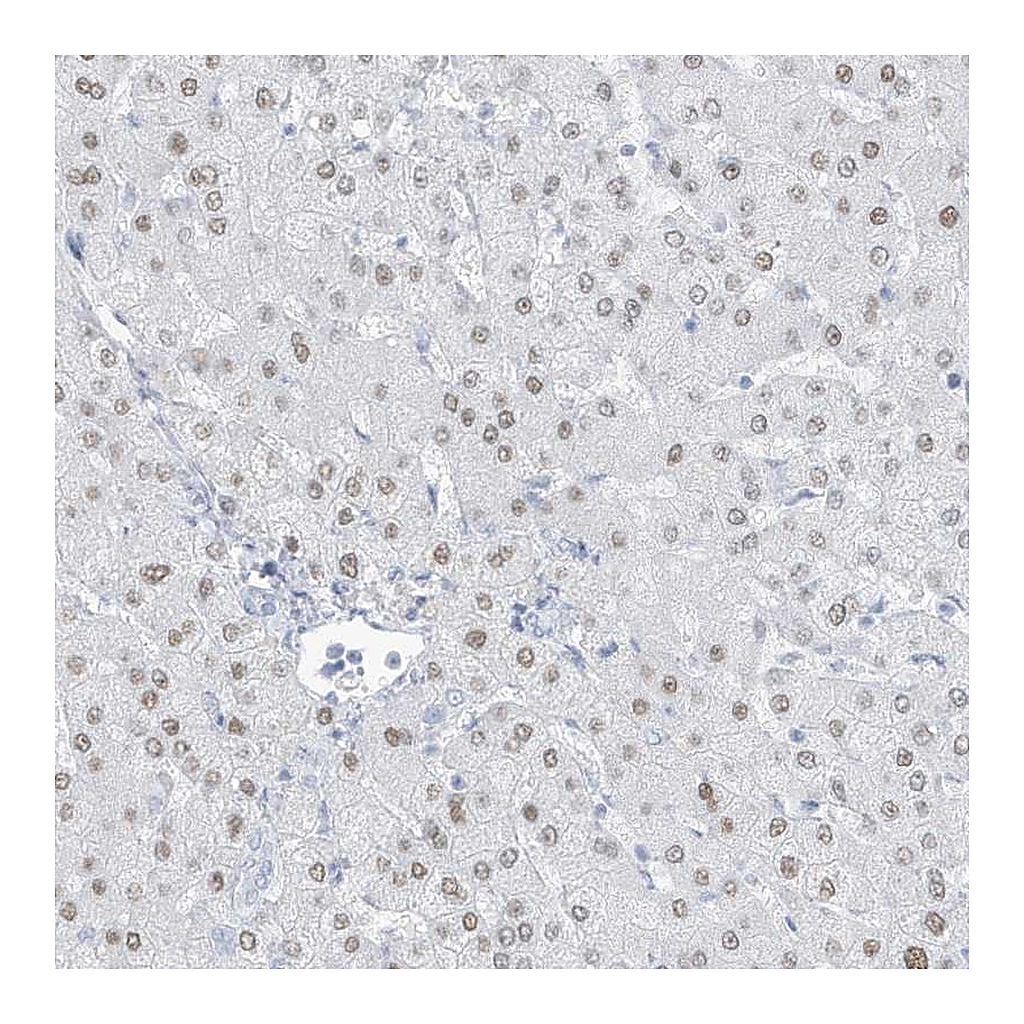 Atlas Antibodies Anti-ZFP64 Antibody