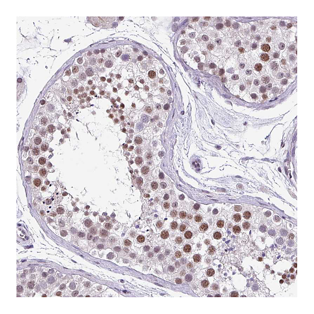 Atlas Antibodies Anti-ZFP3 Antibody