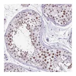 Atlas Antibodies Anti-ZFP3 Antibody