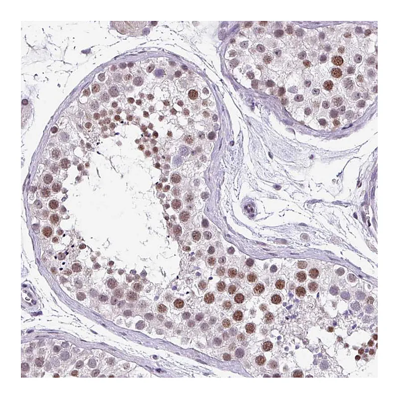 Atlas Antibodies Anti-ZFP3 Antibody