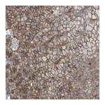 Atlas Antibodies Anti-ZFP90 Antibody