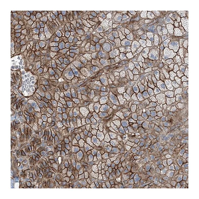 Atlas Antibodies Anti-ZFP90 Antibody