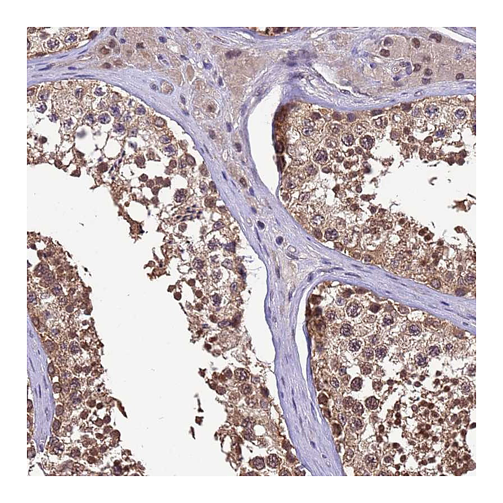 Atlas Antibodies Anti-ZFP69B Antibody