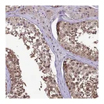 Atlas Antibodies Anti-ZFP69B Antibody