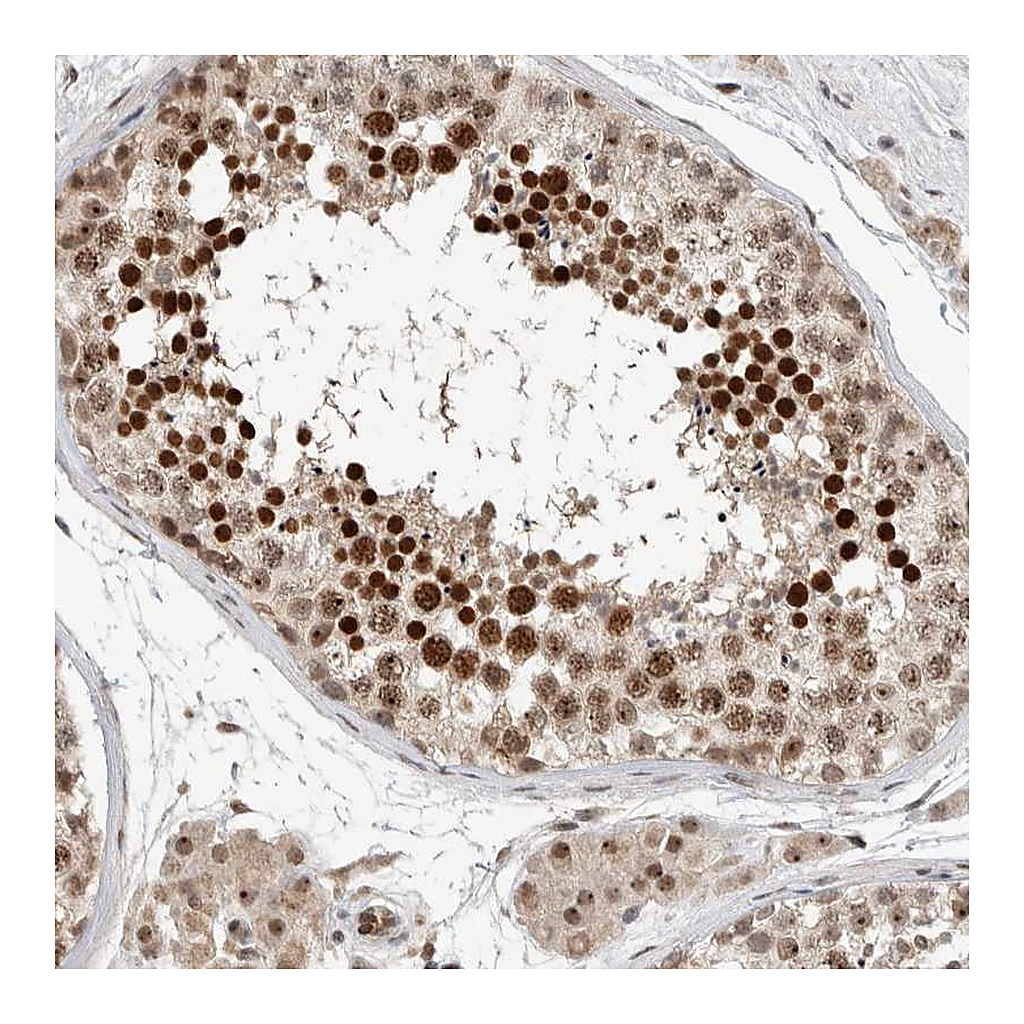 Atlas Antibodies Anti-ZFP91 Antibody
