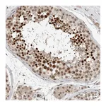 Atlas Antibodies Anti-ZFP91 Antibody