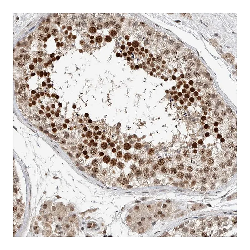 Atlas Antibodies Anti-ZFP91 Antibody