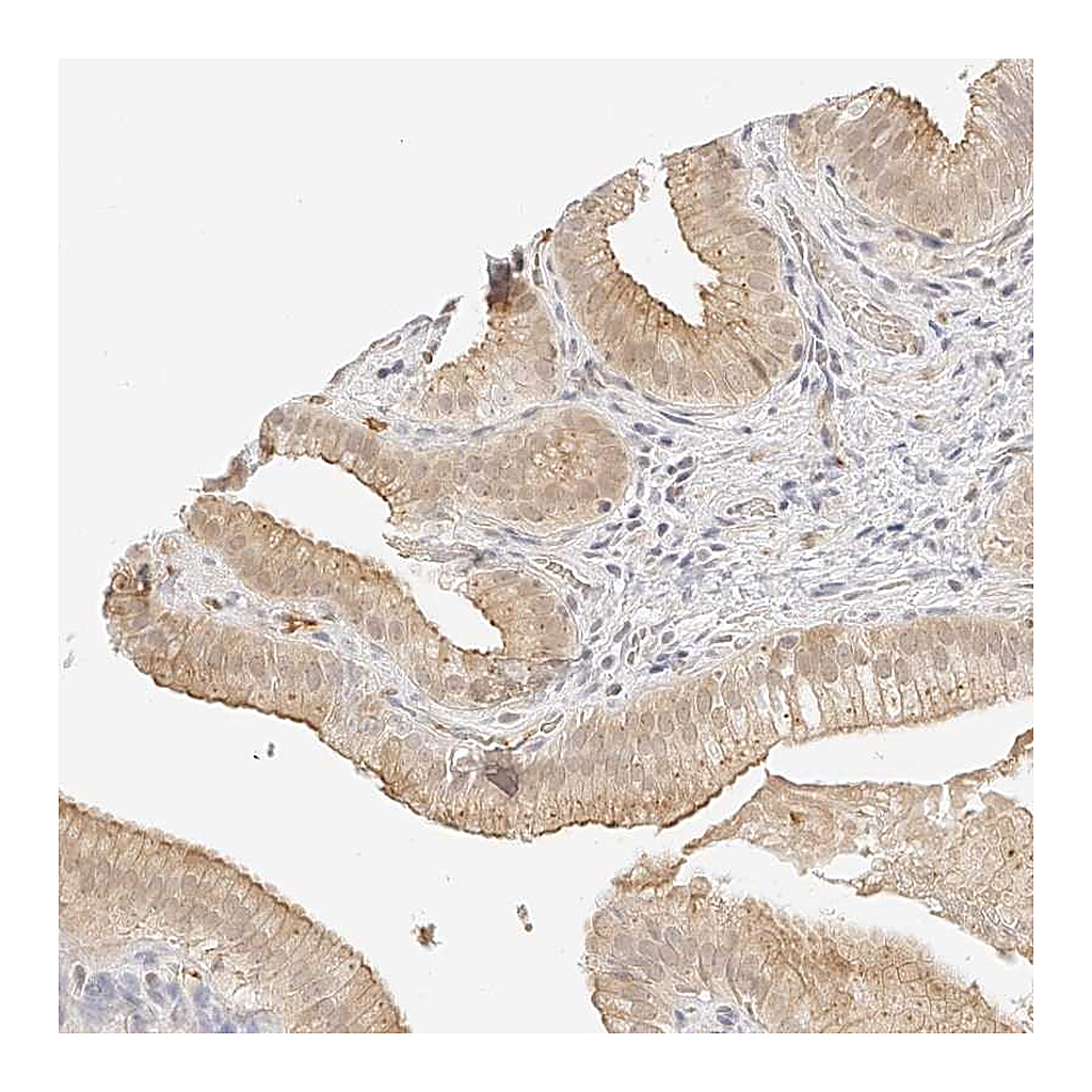 Atlas Antibodies Anti-ZFP69 Antibody