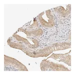 Atlas Antibodies Anti-ZFP69 Antibody