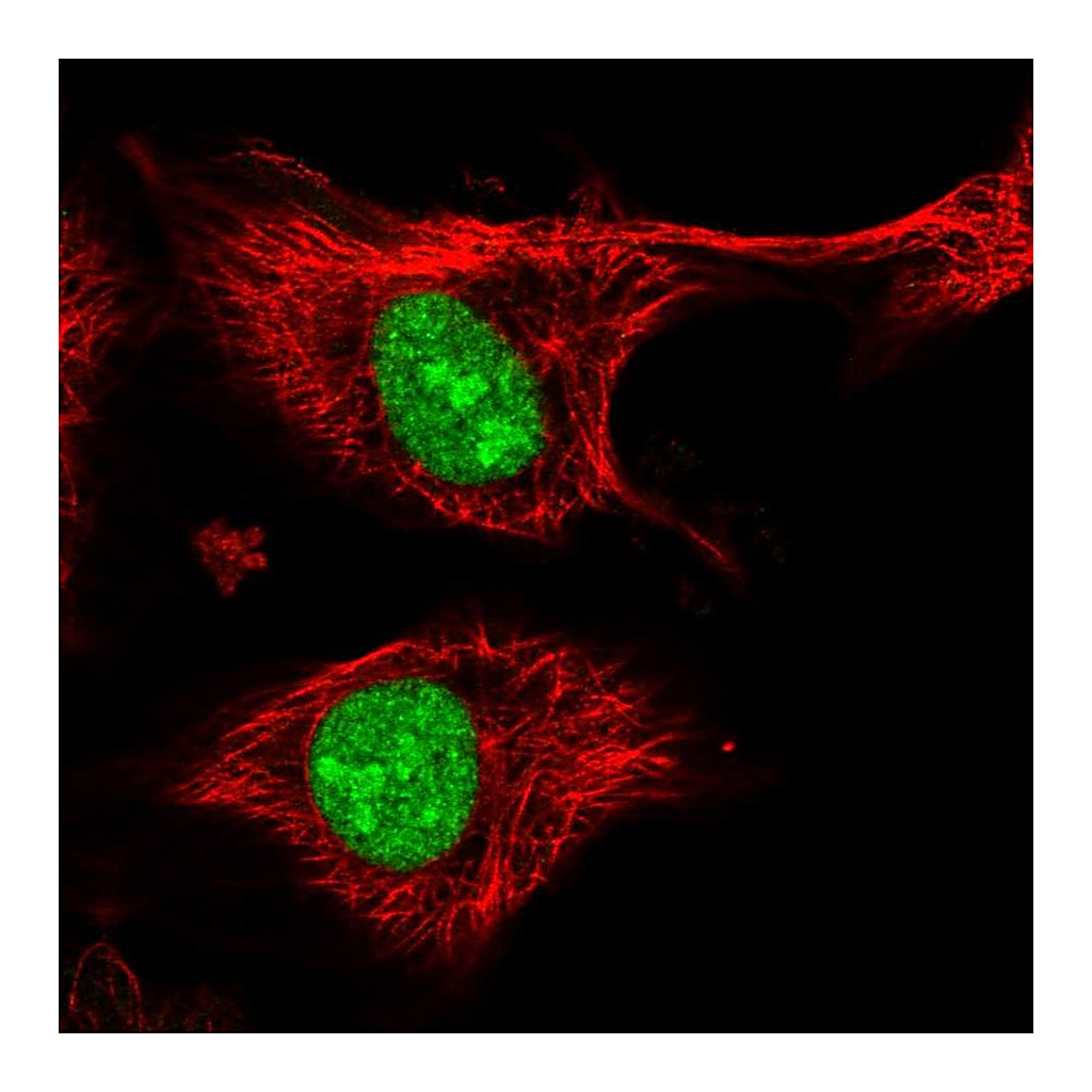 Atlas Antibodies Anti-ZFP91 Antibody