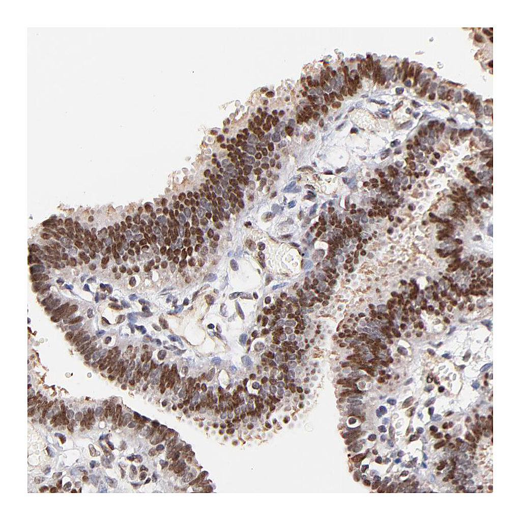 Atlas Antibodies Anti-ZFP92 Antibody