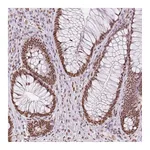 Atlas Antibodies Anti-ZFR2 Antibody