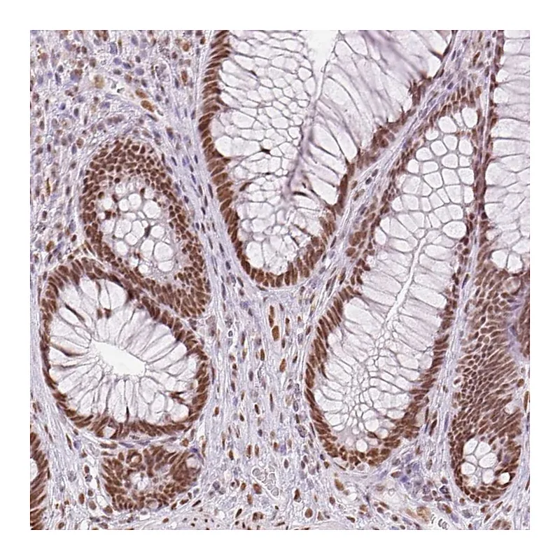 Atlas Antibodies Anti-ZFR2 Antibody