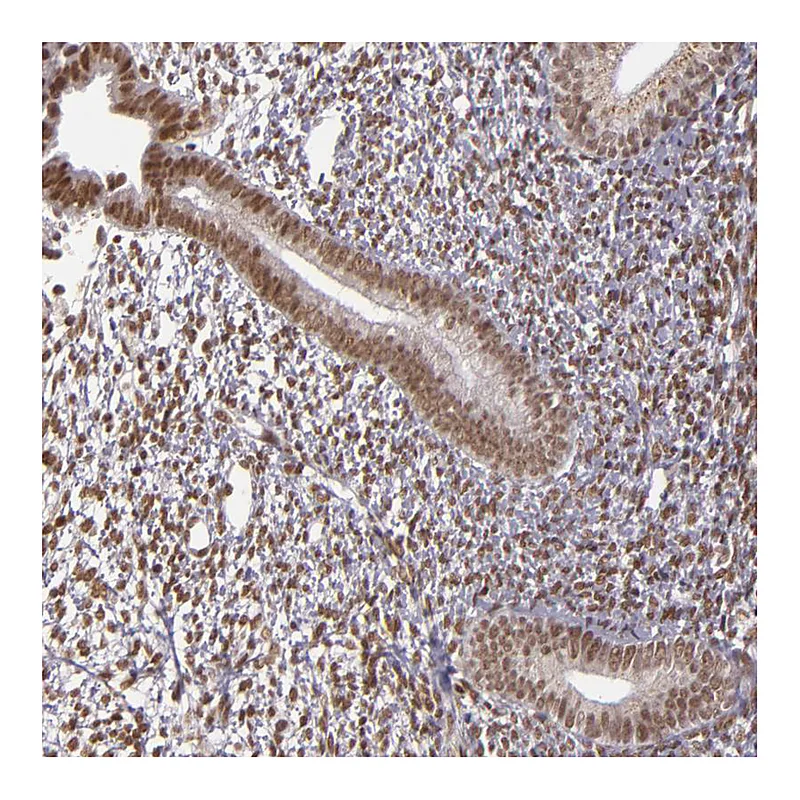 Atlas Antibodies Anti-ZFX Antibody