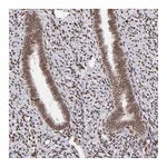 Atlas Antibodies Anti-ZFX Antibody