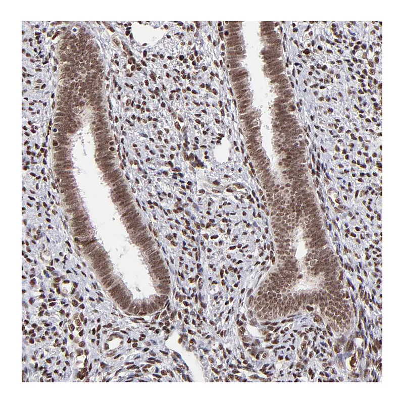 Atlas Antibodies Anti-ZFX Antibody