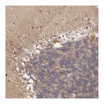 Atlas Antibodies Anti-ZFYVE1 Antibody