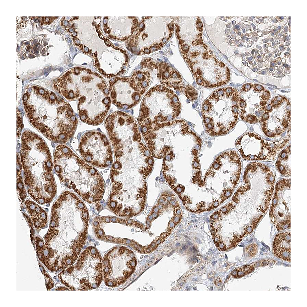 Atlas Antibodies Anti-ZFYVE16 Antibody