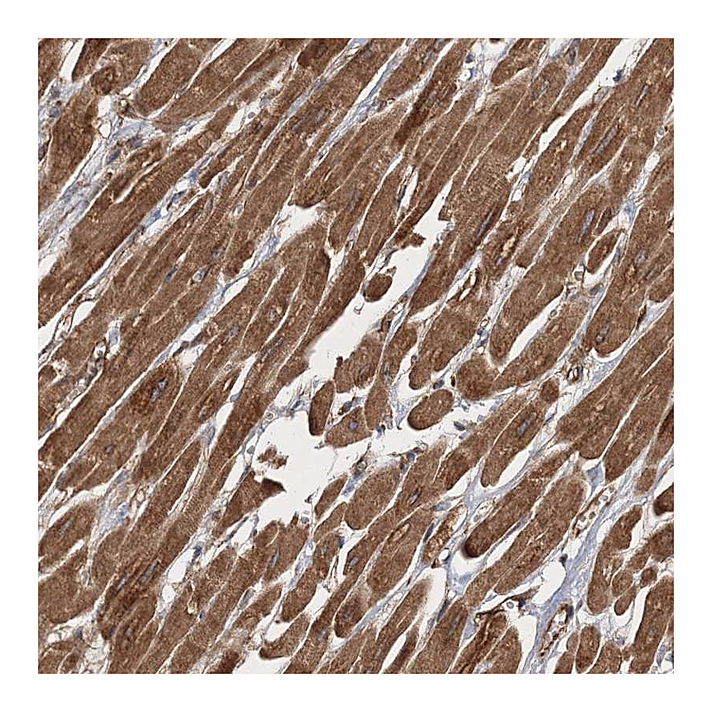 Atlas Antibodies Anti-ZFYVE16 Antibody