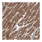 Atlas Antibodies Anti-ZFYVE16 Antibody