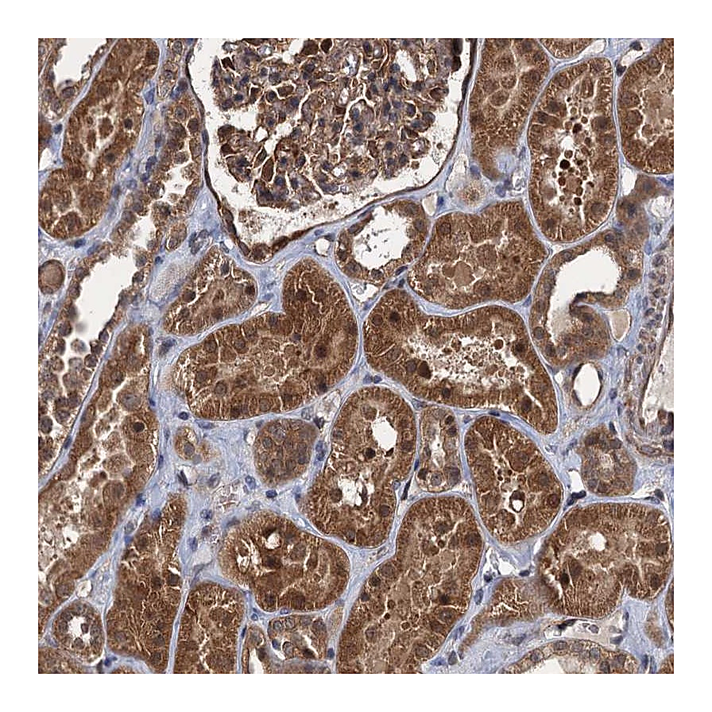 Atlas Antibodies Anti-ZFYVE19 Antibody