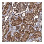 Atlas Antibodies Anti-ZFYVE19 Antibody